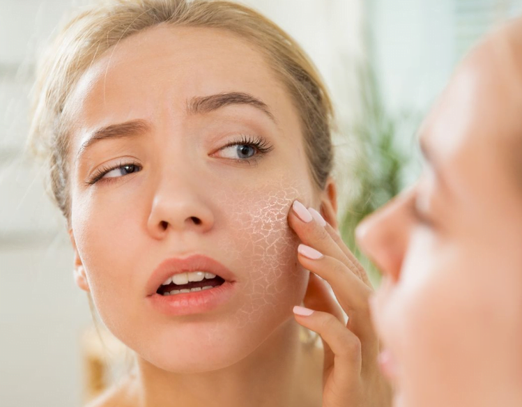 Kandungan Skincare yang Tidak Baik untuk Kulit Sensitif